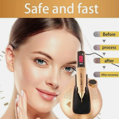 newest ozone 2 in 1 plasma pen professional plasma plasma pen for