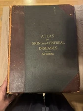 Atlas Of Skin And Venereal Diseases Antique Book 1889