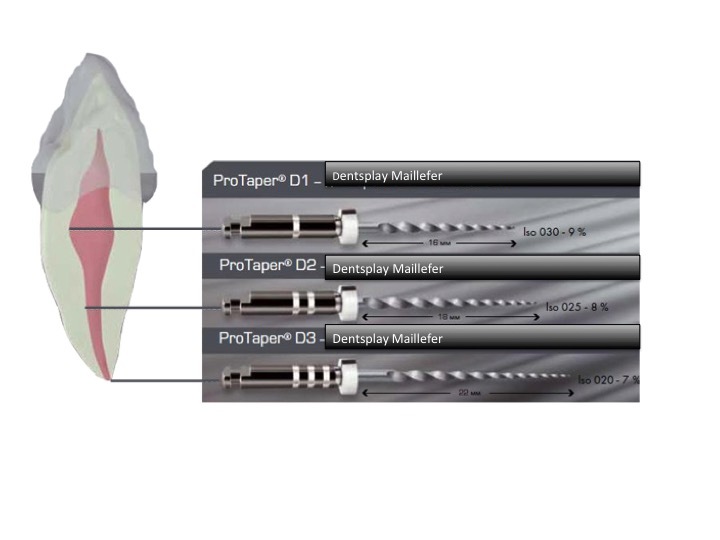 Dentsply ProTaper Gold F1, 25 Mm (žluté - Foto 2
