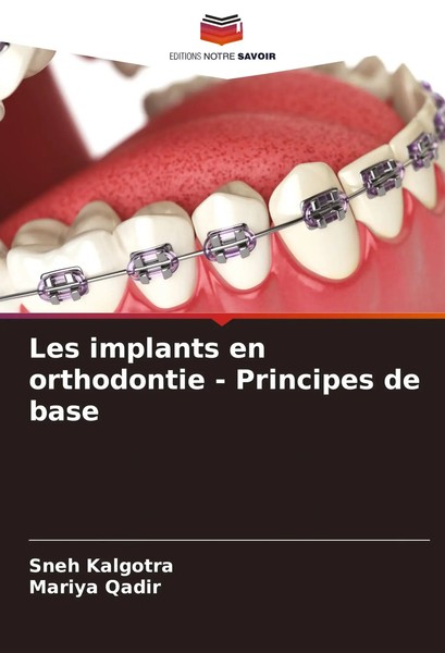 Sneh Kalgotra (U. A.) | Les Implants En Orthodontie - Principes De Base | Buch-image