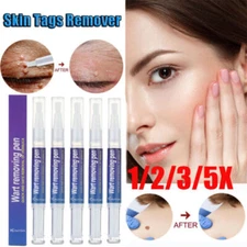 12 Hours Wart Remover Pen Skin Tag Mole Remover Eliminate Foot Corn Warts Unisex