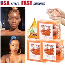 3/1x Tumeric Soap Skin Whitening Dark Spots lightening Acne Brightening Turmeric