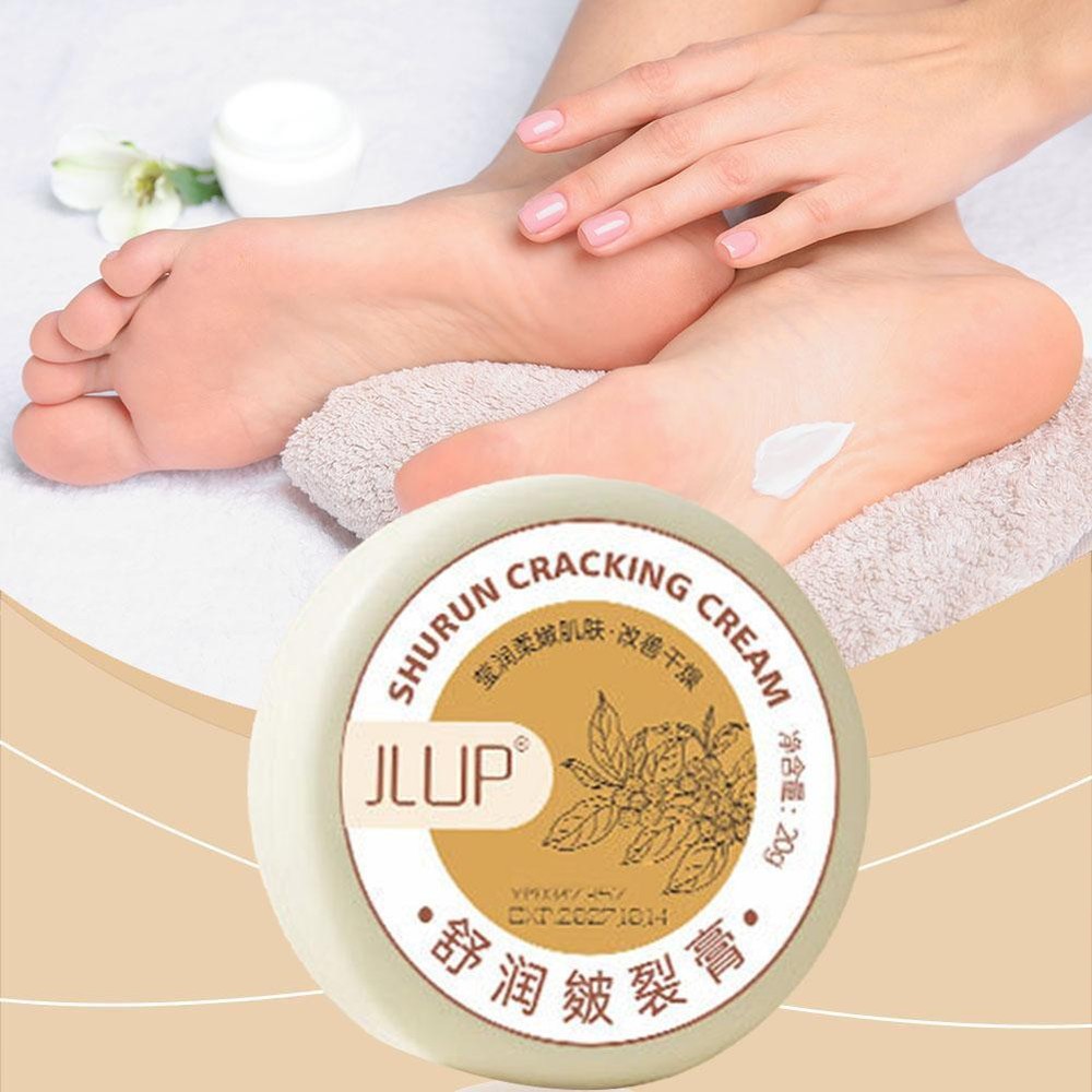 Cracked Skin Repair Cream for Hands & Feet – Anti-Cracking Winter Care W5B2