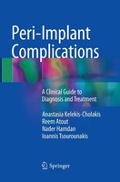 Anastasia Kelekis-Cholakis (U. A.) | Peri-Implant Complications | Taschenbuch