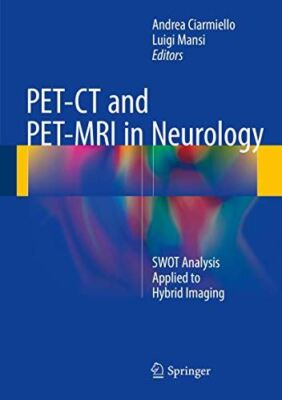 PET-CT and PET-MRI in Neurology: SWOT Analysis Applied to Hybrid