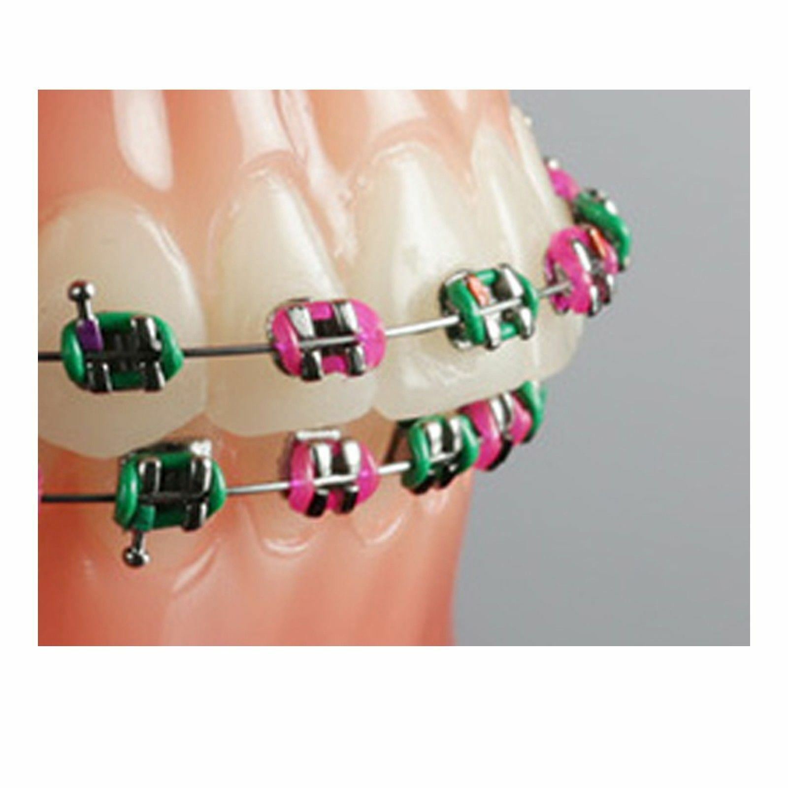 Ortho Module Rings Dental Aesthetic Tooth Orthotodontic Elastic Ligature Modules Assorted ...