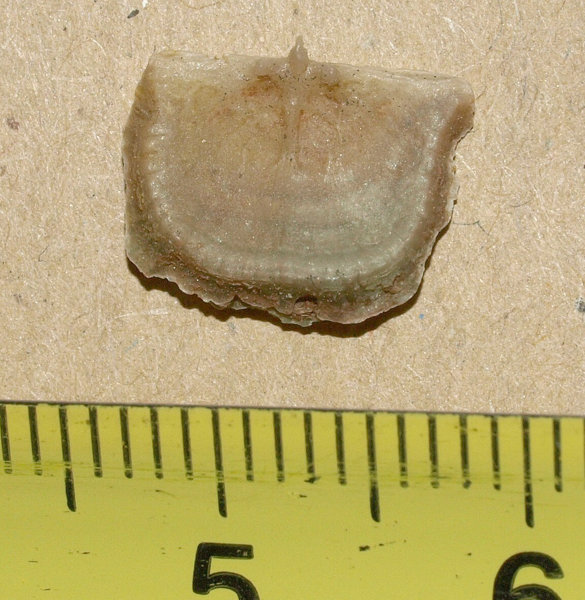 Picture 2 of 11
