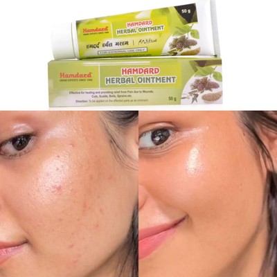 Hamdard Herbal Ointment (50g)Ointment for sprains, pimple, boils and cuts