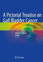 Vinay K Kapoor | A Pictorial Treatise On Gall Bladder Cancer | Taschenbuch