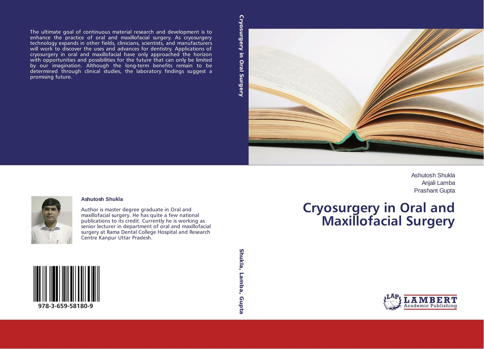 Thumbnail - Ashutosh Shukla (u. A.) | Cryosurgery In Oral And Maxillofacial