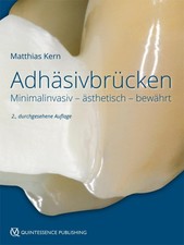 Adhäsivbrücken ~ Matthias Kern ~  978386867...