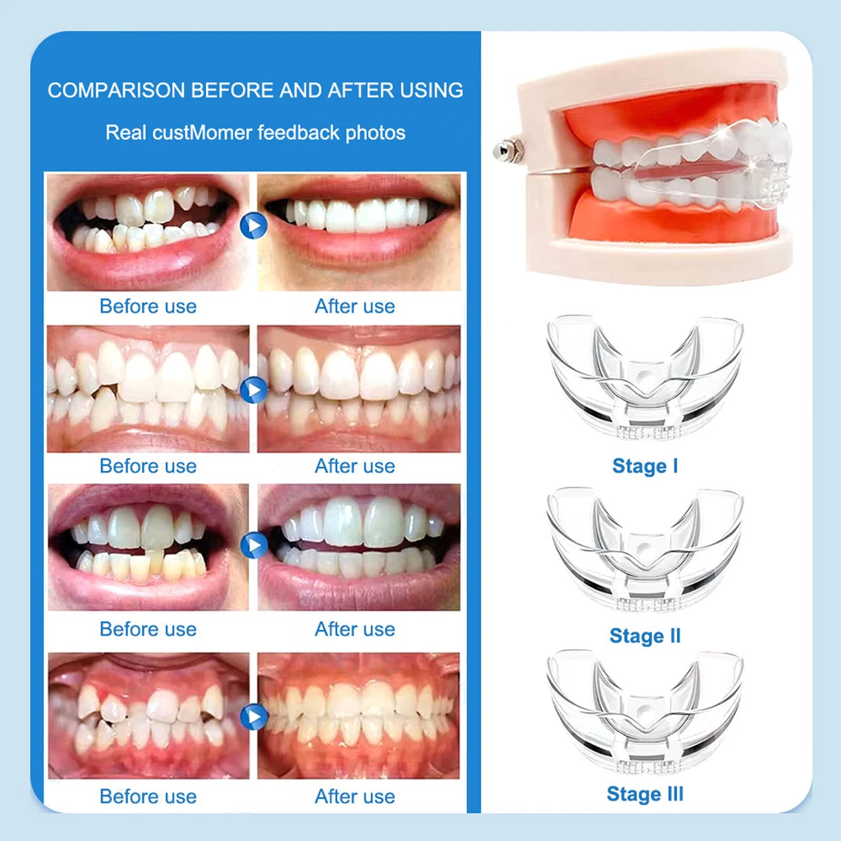 Pro E Contro Degli Apparecchi Dentali - Prima Monza - Foto 9