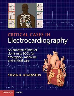 Critical Cases in Electrocardiography Lowenstein Paperback 9781107535916
