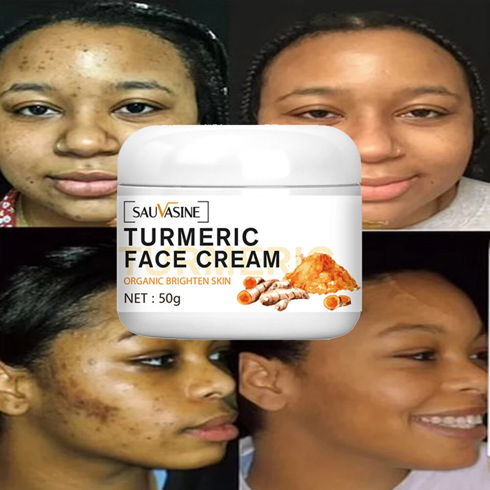 Cream which remove dark cheap spots