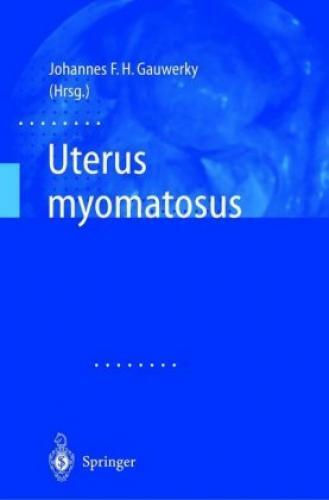 Thumbnail - Uterus Myomatosus 2138