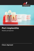 Charu Agrawal | Peri-Implantite | Taschenbuch | Italienisch (2023)