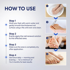 Toenail Fungus Treatment Extra Strength: 25 Undecylenic Acid Tea Tree Oil ...