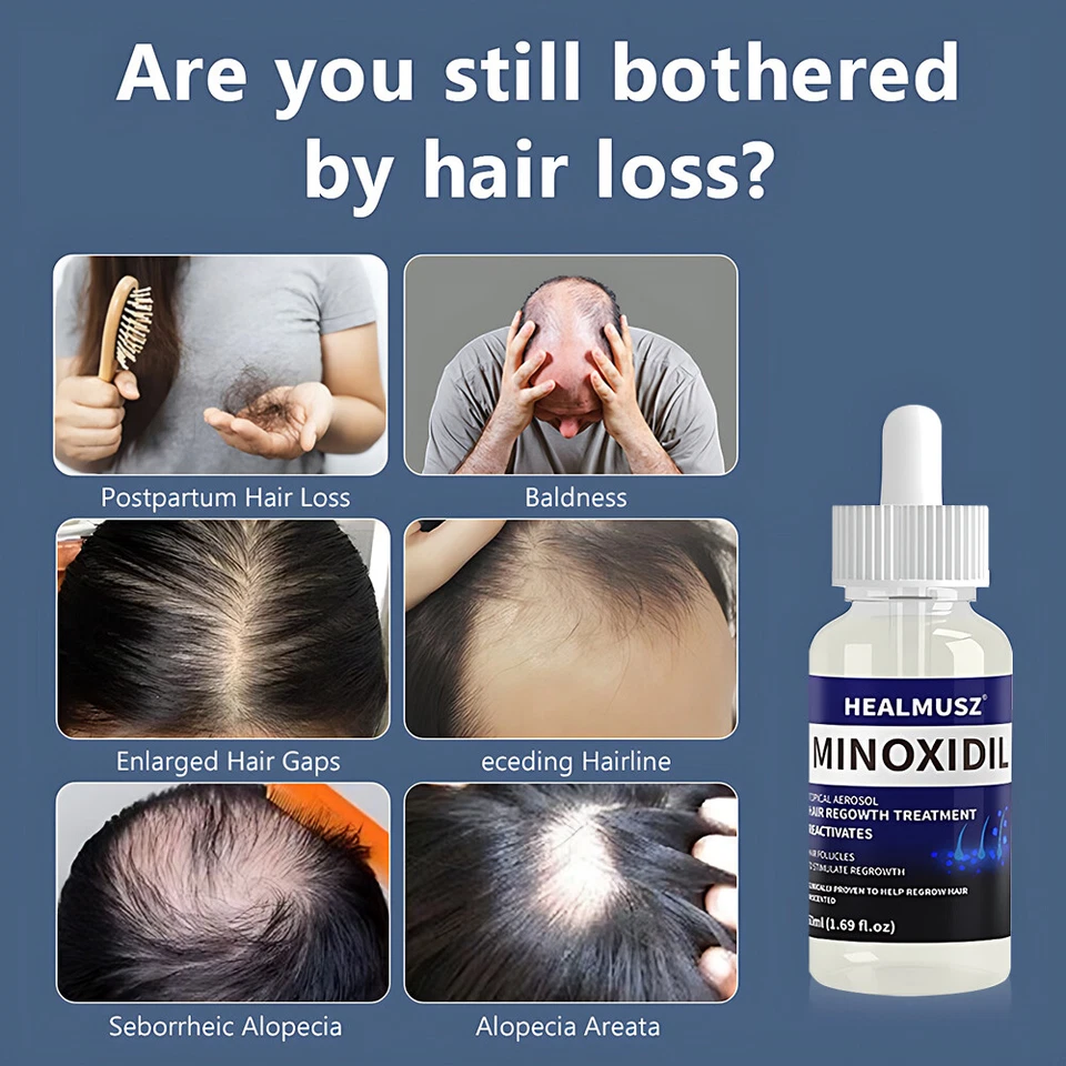 Paquete de 6 | Minoxidil 5% Extra Fuerza Hombres Tratamiento de Regeneración del Cabello Suministro para 4 Meses Foto 3 de 4