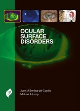 Jose M Benitez-del-Castillo Michael A Ocular Surface Diso (Hardback) (UK IMPORT)
