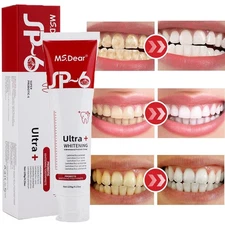 SP-6 Probiotic Toothpaste, 120g Sp-6 Toothpaste Whitening Quick White Toothpaste
