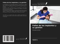 Fallos De Los Implantes Y Su GestióN Rohit S.