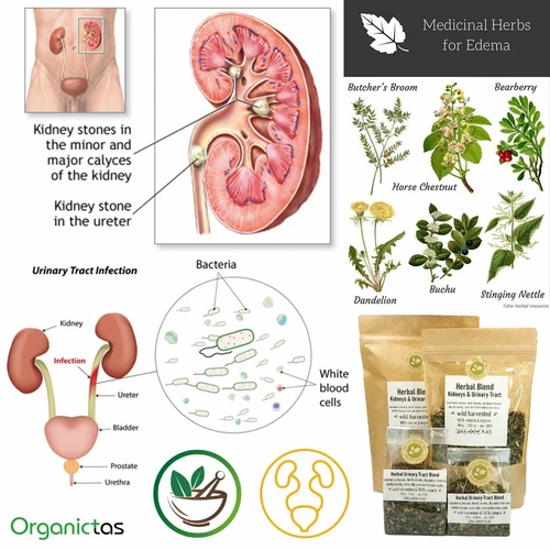 Kidney Tea 6 Herbs Stone Breaker, Urinary Tract Health, Diuretic, Bladder, UTI