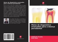Meios De DiagnóStico AvançAdos Para A DoençA Periodontal Siddharth Tevatia