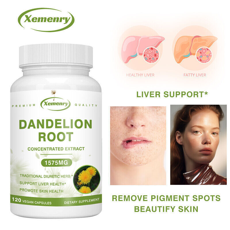 Complément Alimentaire Racine De Pissenlit 1575mg - 30/60/120 Gélules, Détox Et Diurétique Naturel