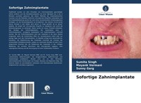 Sofortige Zahnimplantate Sumita Singh