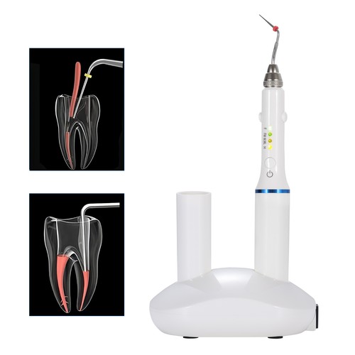 Sistema di otturazione dentale penna riscaldata endo canale radicolare penna di riempimento hot melt e 4 punte - Foto 8 di 23
