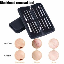 9 piece Blackhead Cleaner / Remover Acne/Comedone Extractor Tool Easy extraction