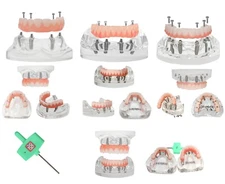 US Dental Implant Model Overdenture Upper/Lower jaw Teeth Model with 4/6 Screws