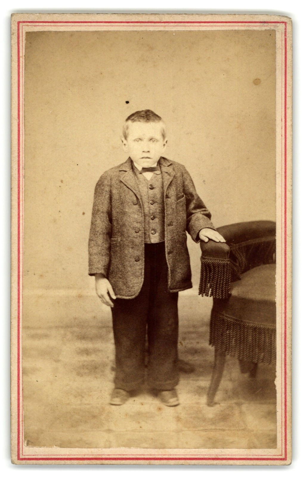 Antique CDV Circa 1860s Dengler Cute Hunchback Young Boy In Suit Slatington Pa