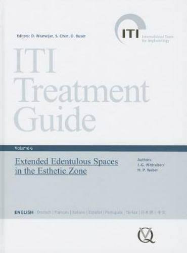 ITI Treatment Guide Volume 1~6