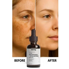 Dark Skin Whitening Dark spot Brightening Bleaching Lightening Face body Serum