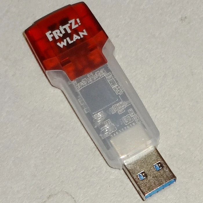 AVM