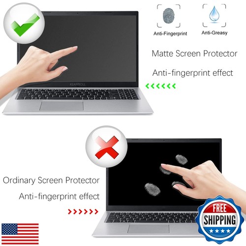 KEANBOLL 3Pcs Matte Anti-Glare Screen Protector For Apple MacBook 12 Inch Wit - Afbeelding 4 van 5