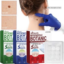 MICRONEEDLE BOTANIC Skin Tag  Acne Patch Skin Tag Remover Patches 9Pcs HOT