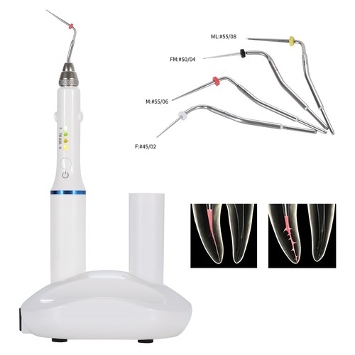 Sistema di otturazione dentale penna riscaldata endo canale radicolare penna di riempimento hot melt e 4 punte - Foto 4 di 23