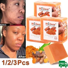 3/1x Tumeric Soap Skin Whitening Dark Spots lightening Acne Brightening Turmeric