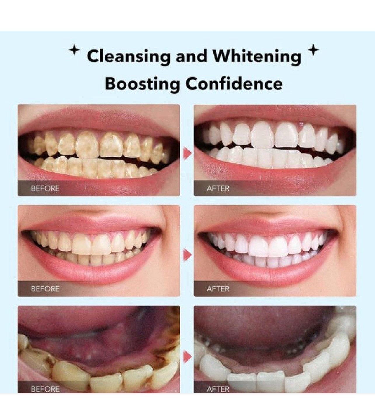 SP-6 Probiotic Toothpaste SP-6 Toothpaste Whitening Quick White Toothpaste 3 New