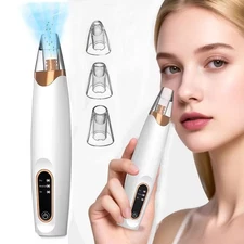 Blackhead Remover Pore Vacuum,Facial Pore Cleaner-3 Suction Power,3 Probes, USB