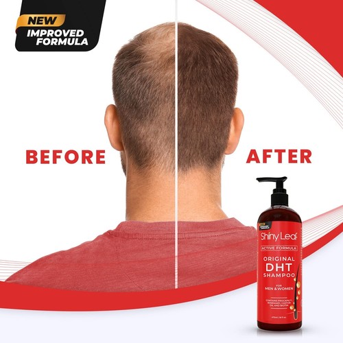 SHINY LEAF DHT BLOCKER SHAMPOO Caffeine Hair Omega Loss Growth 473ml - Picture 7 of 9