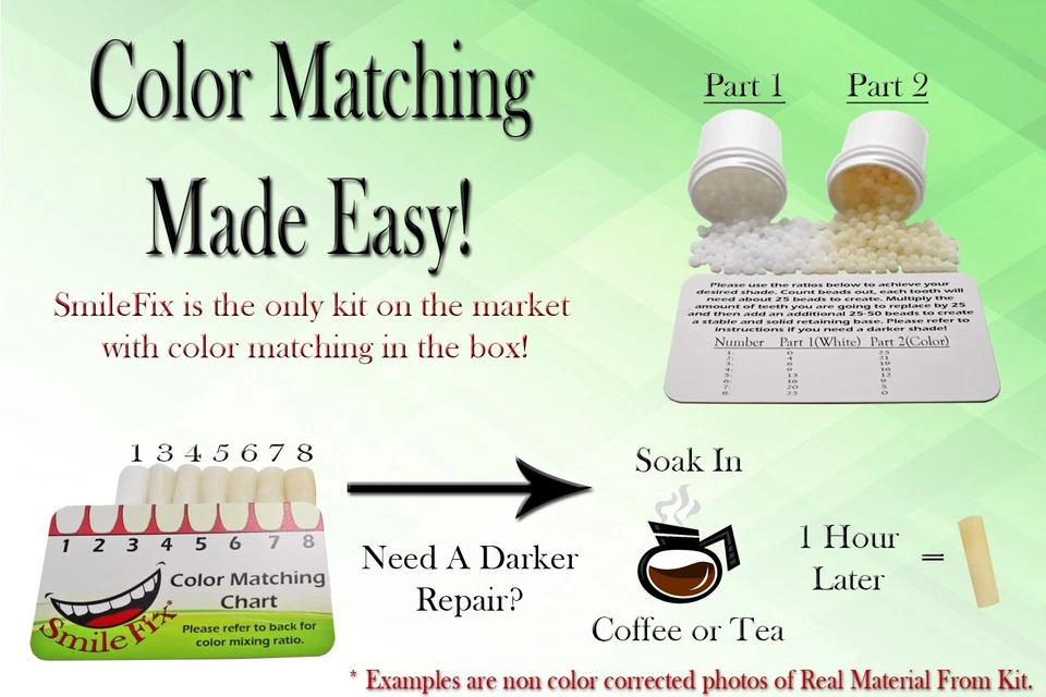 Kit de reparación dental de lujo a juego de colores SmileFix - Reemplazar faltante o roto... Foto 3 de 4