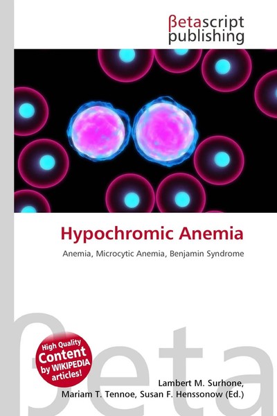Lambert M. Surhone (U. A.) | Hypochromic Anemia | Taschenbuch | Englisch (2026)-image