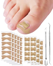 Ingrown Toenail Correction Treatment Tool, 60Pcs Ingrown Toe Nail Corrector Patc