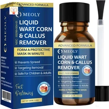 Fast Acting Wart Remover Plantar and Genital HPV Treatment Ointment Painless #1