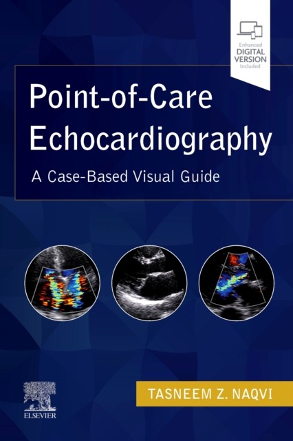 PointofCare Echocardiography PAPERBACK 9780323612845 - Image 4