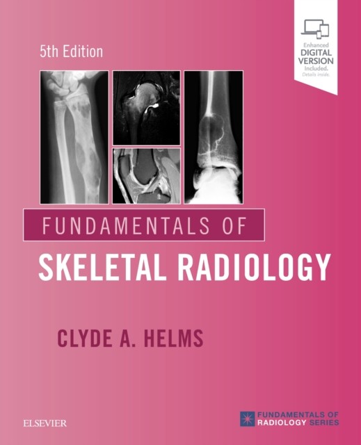 Fundamentals of Skeletal Radiology by Clyde A., MD  Helms (Paperback Book)