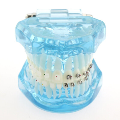 1Pcs Dental Orthodontic Teeth Model  With Metal Ceramic Brackets Study Blue 3003
